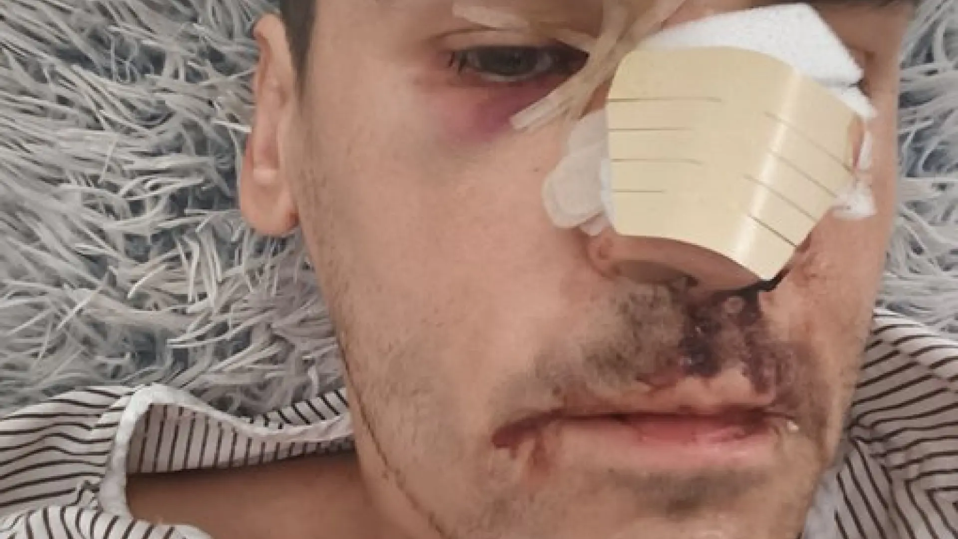 El periodista Fonsi Loaiza denuncia haber sufrido una agresión en Cádiz: «Lo último que recuerdo es que me llamaron rojo»