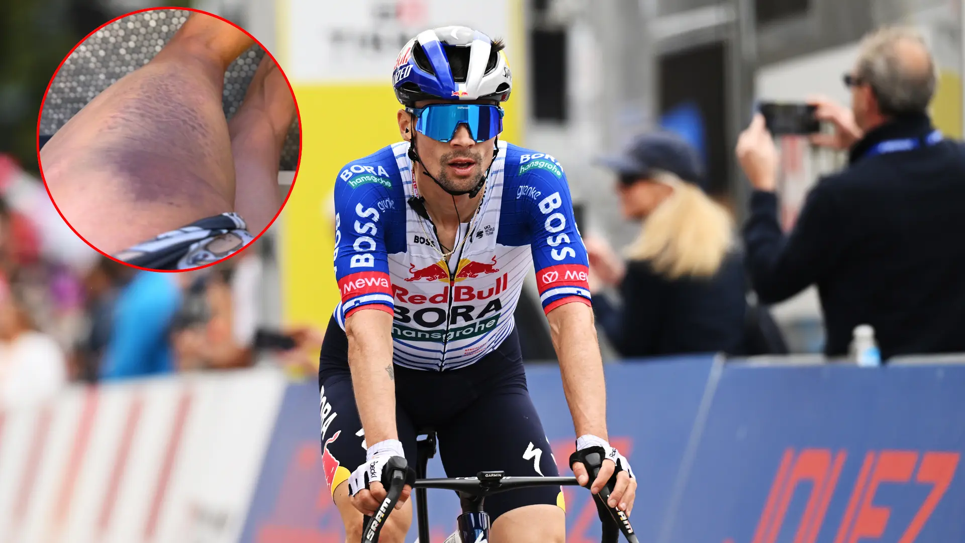 Primoz Roglic sufre un atropello y dispara las dudas antes de La Vuelta a España: «Me golpeó un coche hace unos días, la vida es así»