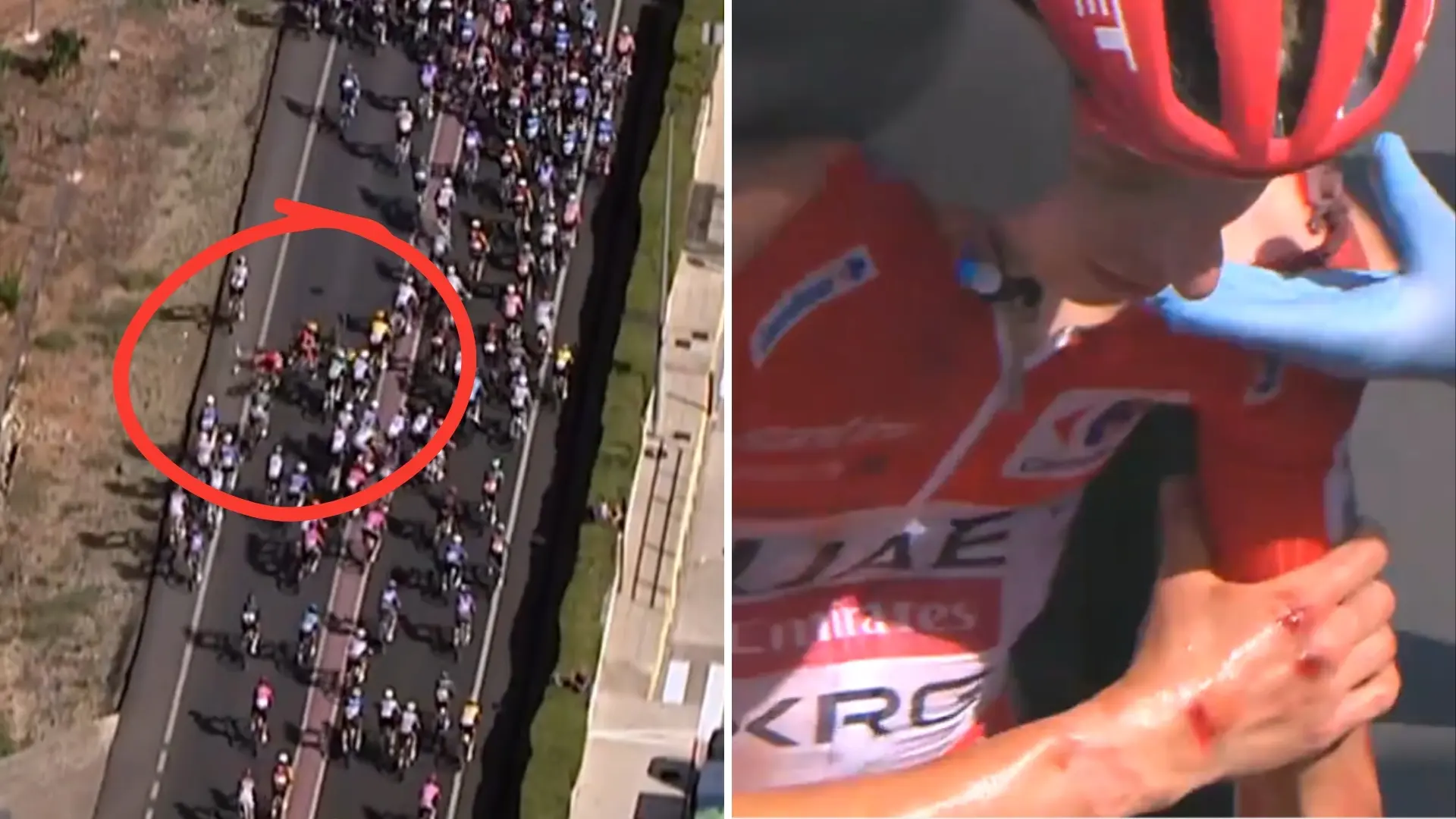 Así fue la terrorífica caída de Pogacar en La Vuelta a España: golpe al pelotón y traumatismo craneoencefálico