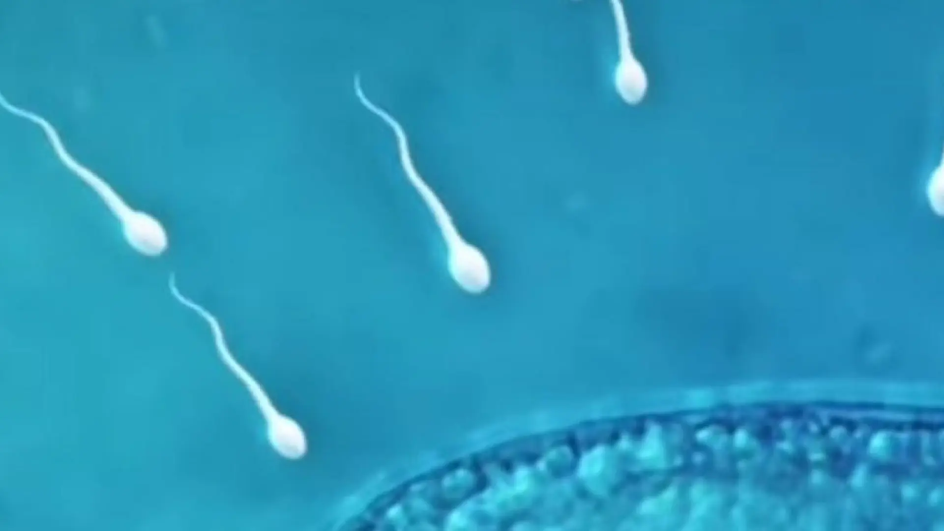Un donante de esperma de los Países Bajos dice ser padre de 199 niños nacidos en cuatro países