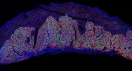 Un estudio revela el papel clave de una proteína en la formación de la placenta y el crecimiento del feto