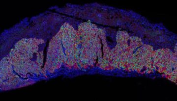 Un estudio revela el papel clave de una proteína en la formación de la placenta y el crecimiento del feto