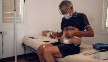 Pere Hermoso, de 65 años: Con la diálisis en casa, si quiero irme de vacaciones, me voy