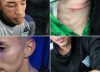 Victoriano Arenas mostró las heridas de cuatro de sus jugadores y Luis Ventura, que pasó la noche internado, denunció: «Liberaron a los barras para que nos masacren»
