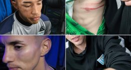 Victoriano Arenas mostró las heridas de cuatro de sus jugadores y Luis Ventura, que pasó la noche internado, denunció: «Liberaron a los barras para que nos masacren»