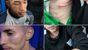 Victoriano Arenas mostró las heridas de cuatro de sus jugadores y Luis Ventura, que pasó la noche internado, denunció: «Liberaron a los barras para que nos masacren»