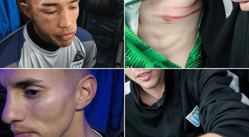 Victoriano Arenas mostró las heridas de cuatro de sus jugadores y Luis Ventura, que pasó la noche internado, denunció: «Liberaron a los barras para que nos masacren»