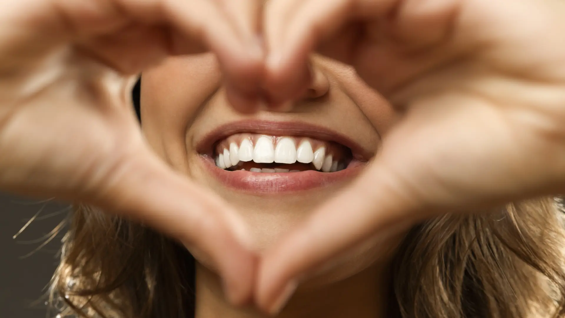 Qué es la blancorexia: estos son los peligros de la decoloración dentaria