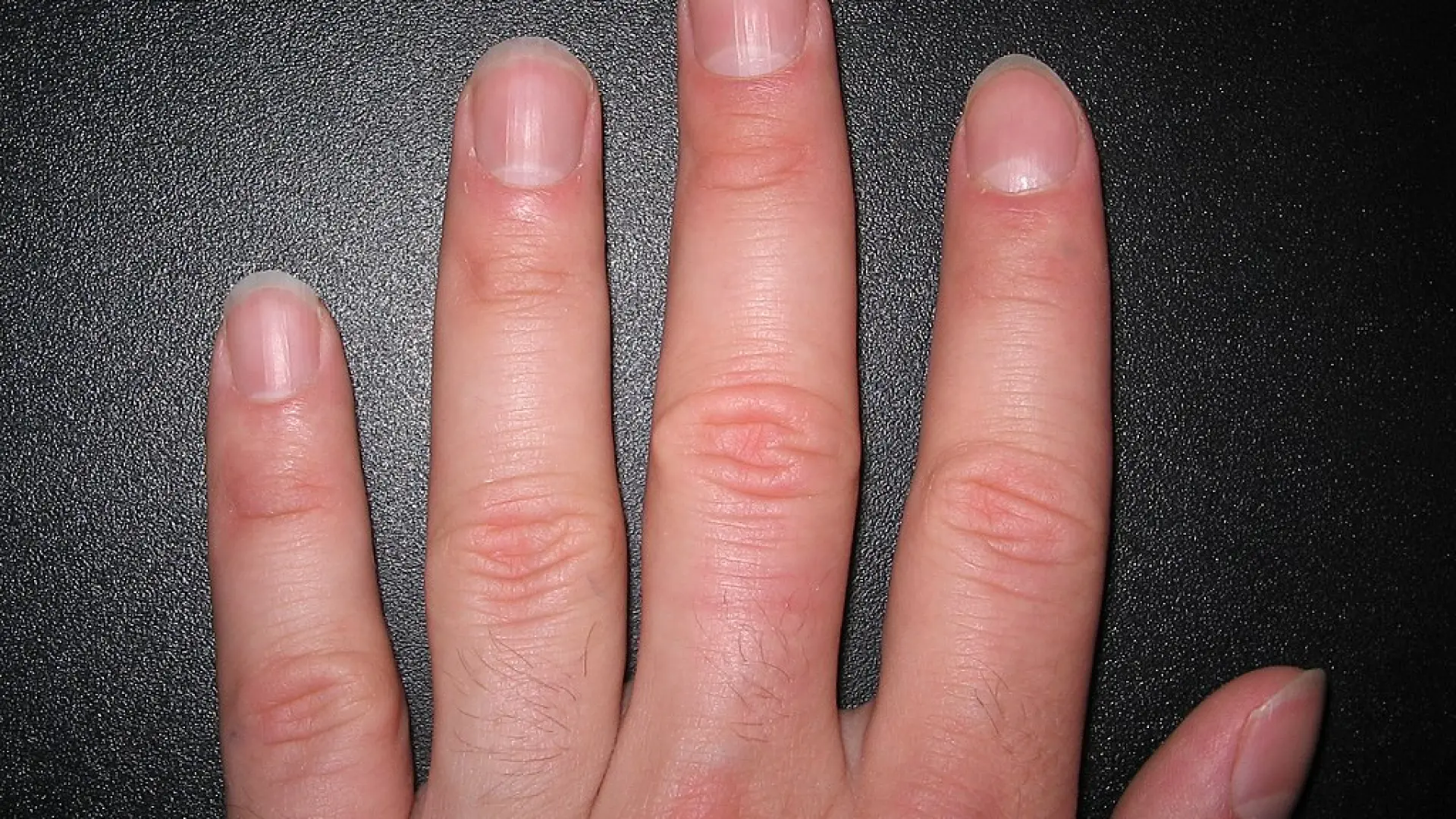 Lo que nunca debes hacer con tus uñas, según una dermatóloga: "No seas cavernícola"
