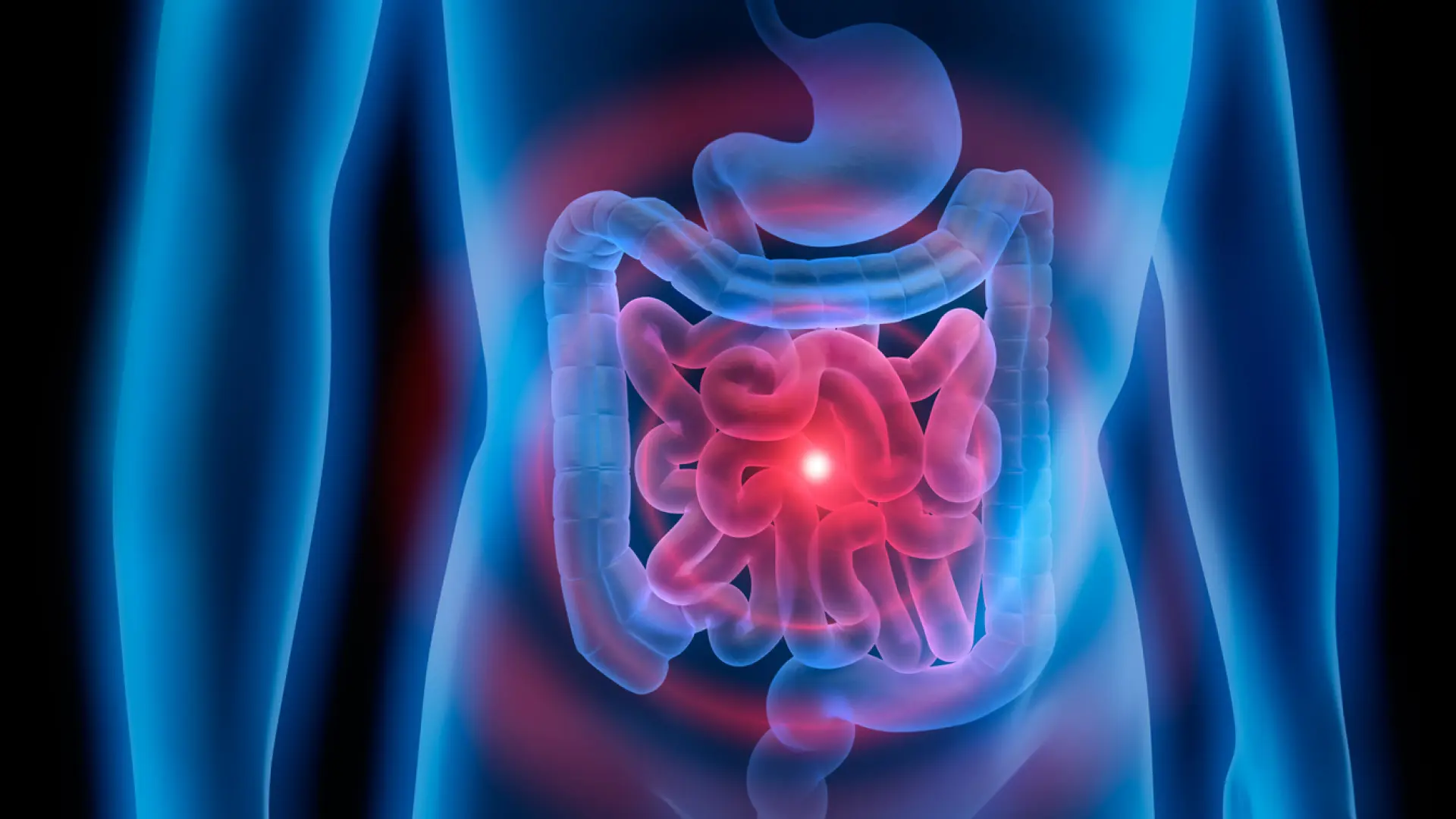 Un ensayo pionero realizado en seis países revela un método natural para reducir el riesgo de cáncer de colon