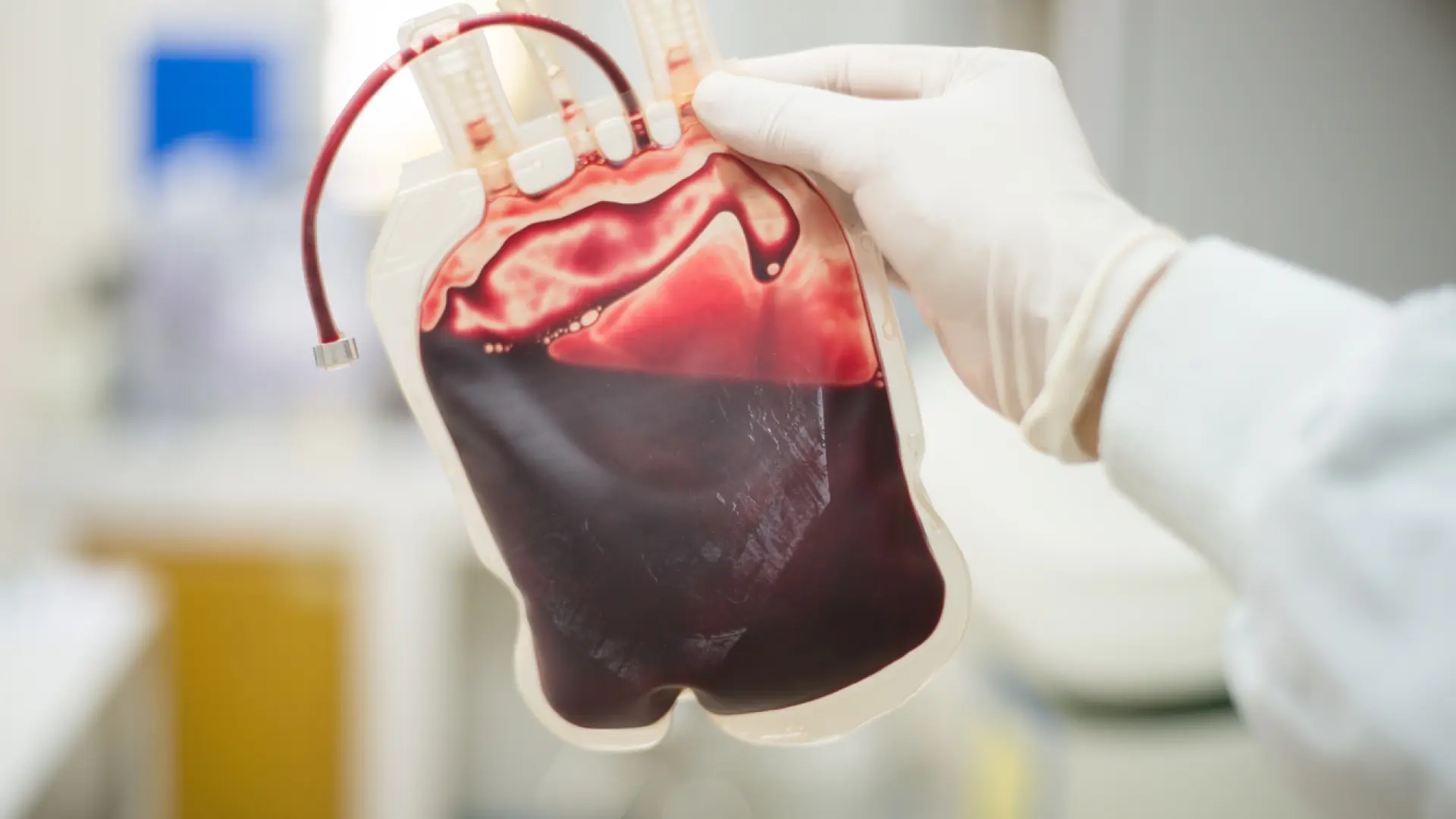 Científicos japoneses desarrollan sangre artificial apta para todos los grupos sanguíneos