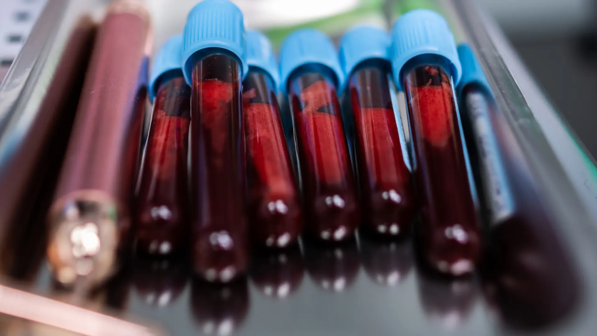 Esperanzador descubrimiento: identifican una nueva proteína en la sangre para detectar la enfermedad arterial coronaria
