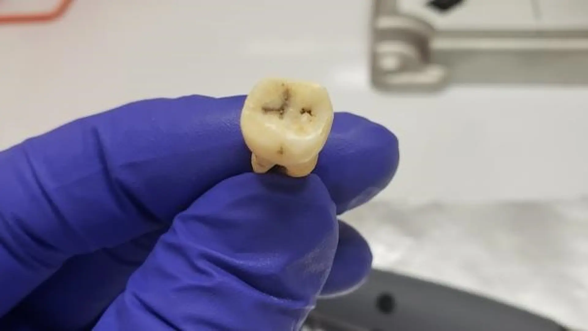 Descubren la bacteria responsable de la peste de Justiniano, la primera pandemia registrada de la historia que golpeó al Imperio Bizantino