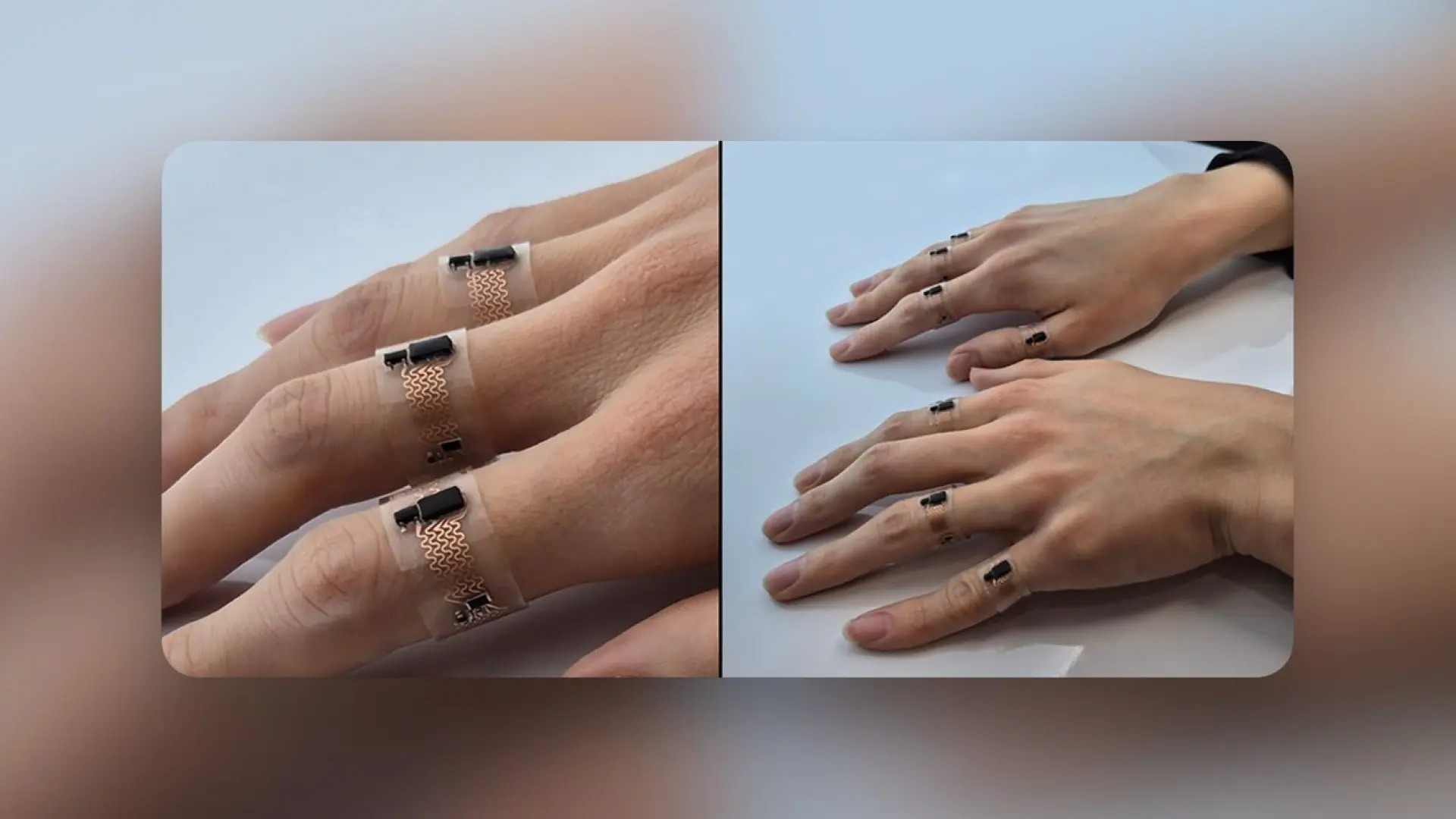 Este anillo inteligente es capaz de traducir la lengua de signos con una precisión casi total