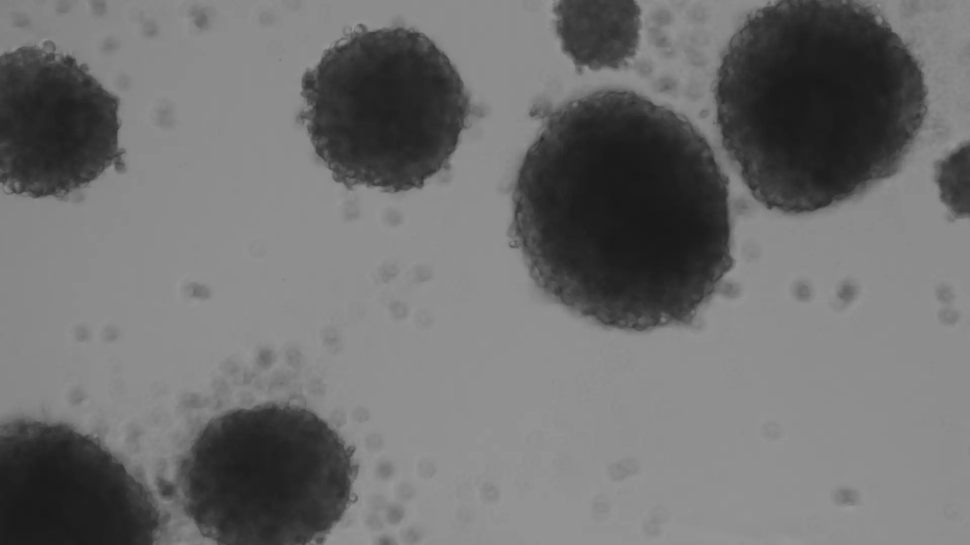 Un equipo catalán diseña un método con luz capaz de activar una molécula y eliminar las células madre del cáncer, que causan las recaídas