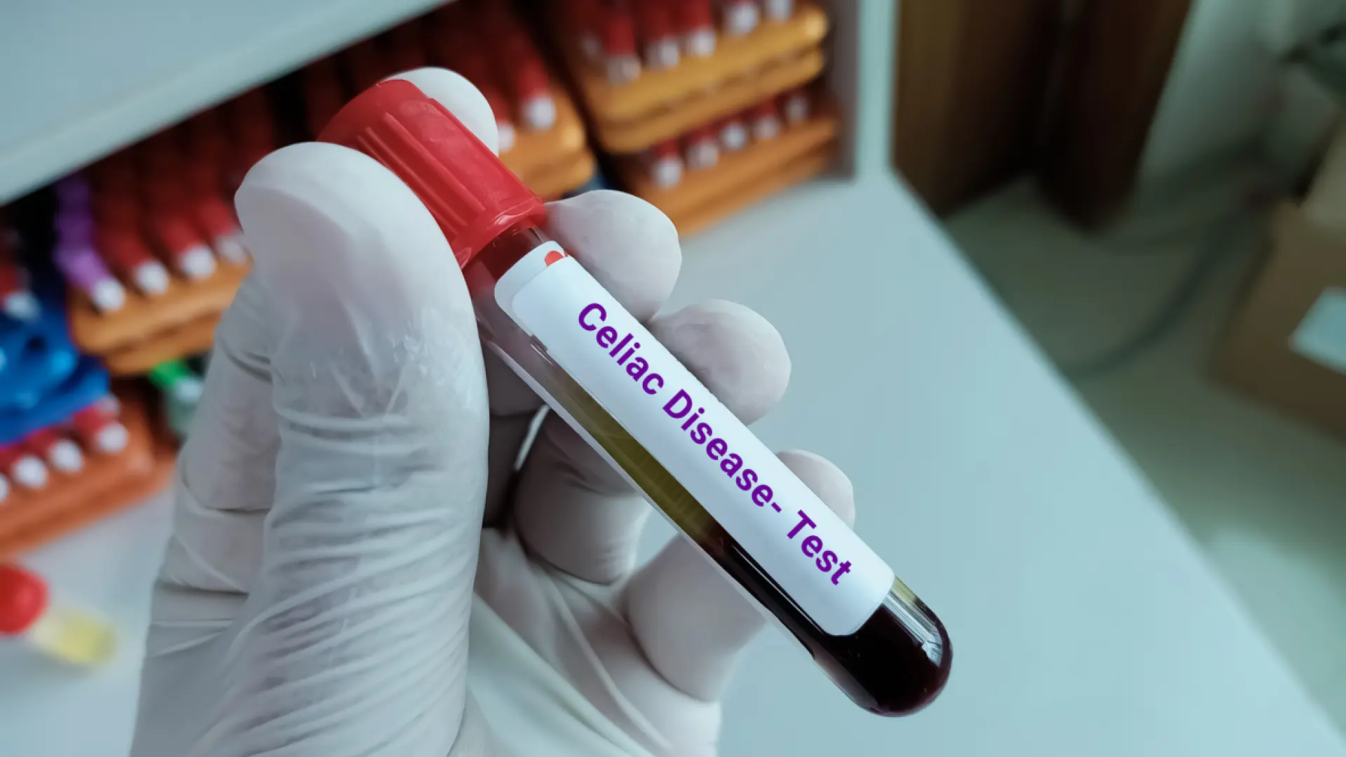 Científicos de Barcelona desarrollan una molécula que podría evitar los síntomas de la enfermedad celíaca