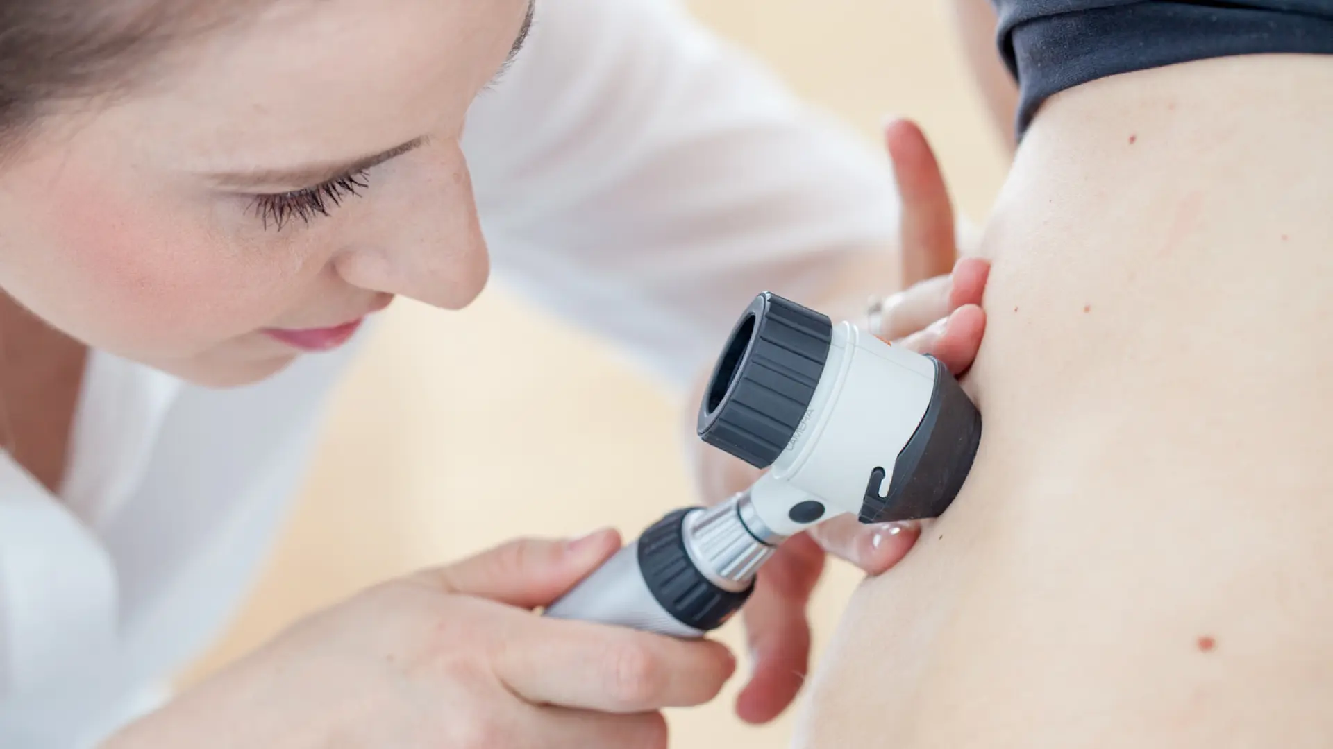 Una potencial vacuna contra el cáncer reduce el riesgo de recurrencia y muerte en un 49% en los casos de melanoma
