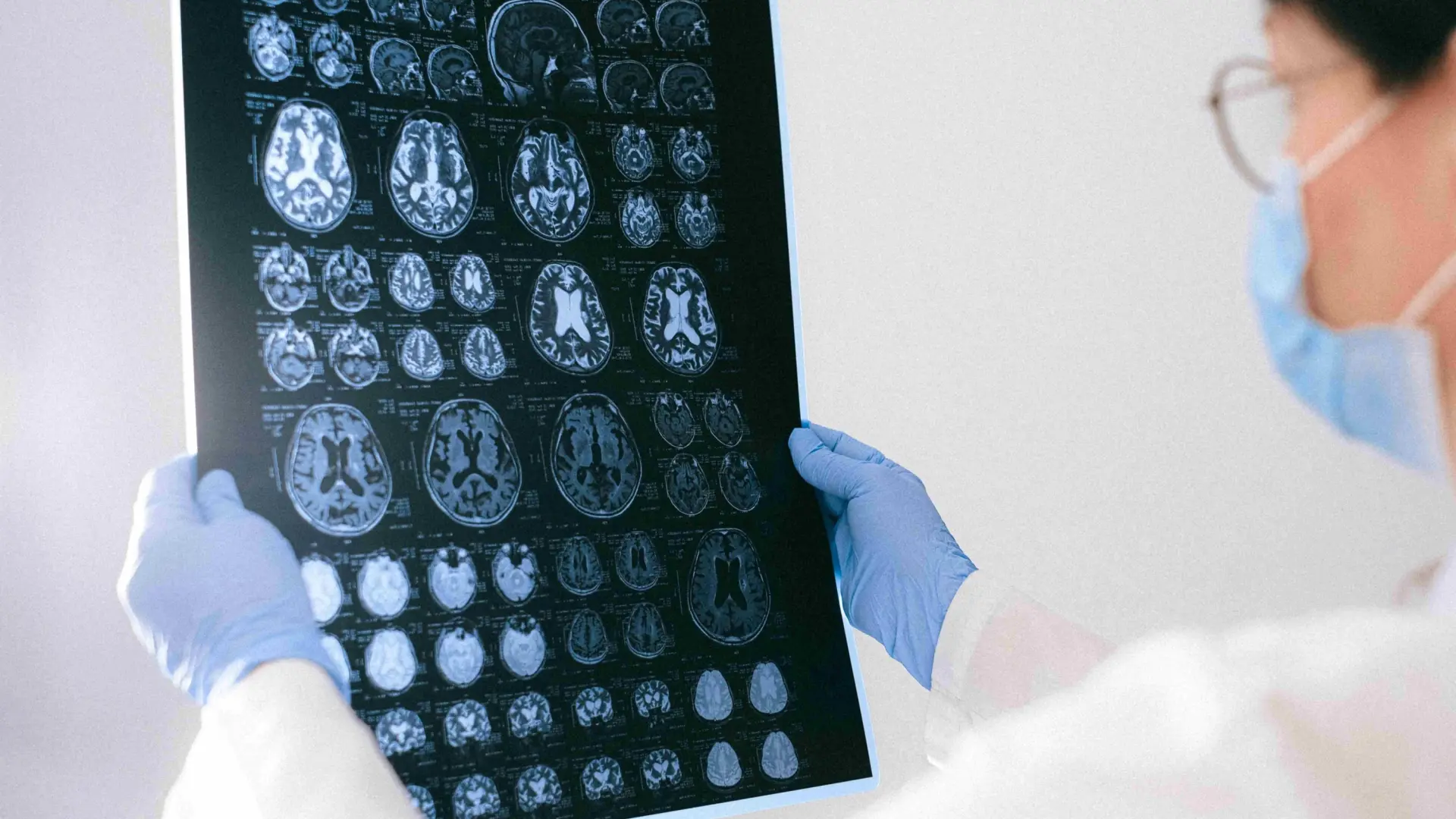 El milagro de Connor: una terapia experimental logra que un menor con epilepsia grave camine sin ayuda