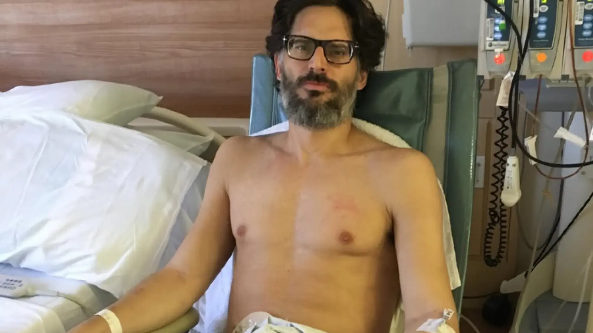 Joe Manganiello, 'Mr 0' en 'One Piece', muestra cómo le extirparon el intestino grueso: «Perdí 27 kilos en dos semanas»