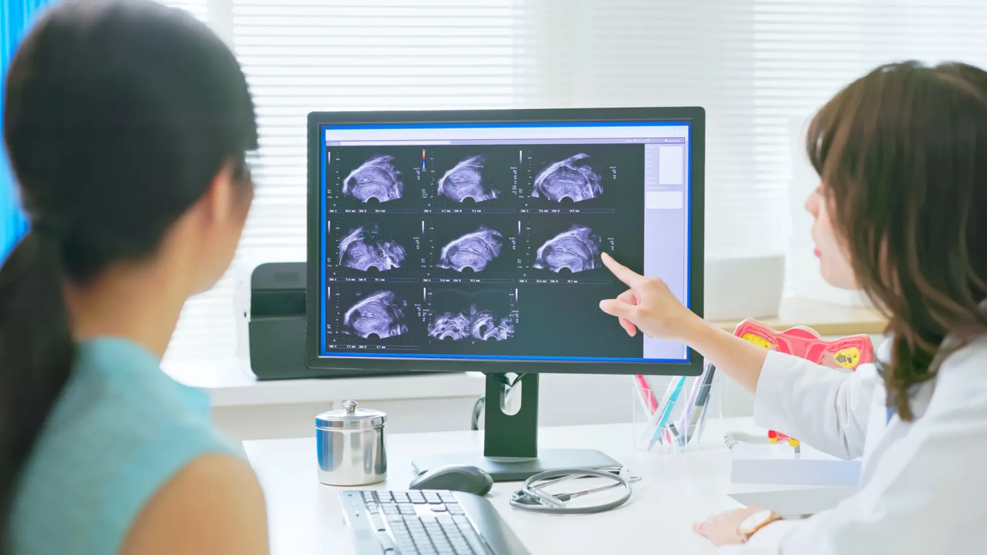 Un nuevo fármaco reduce un 32% el riesgo de muerte en cáncer de endometrio avanzado o recurrente