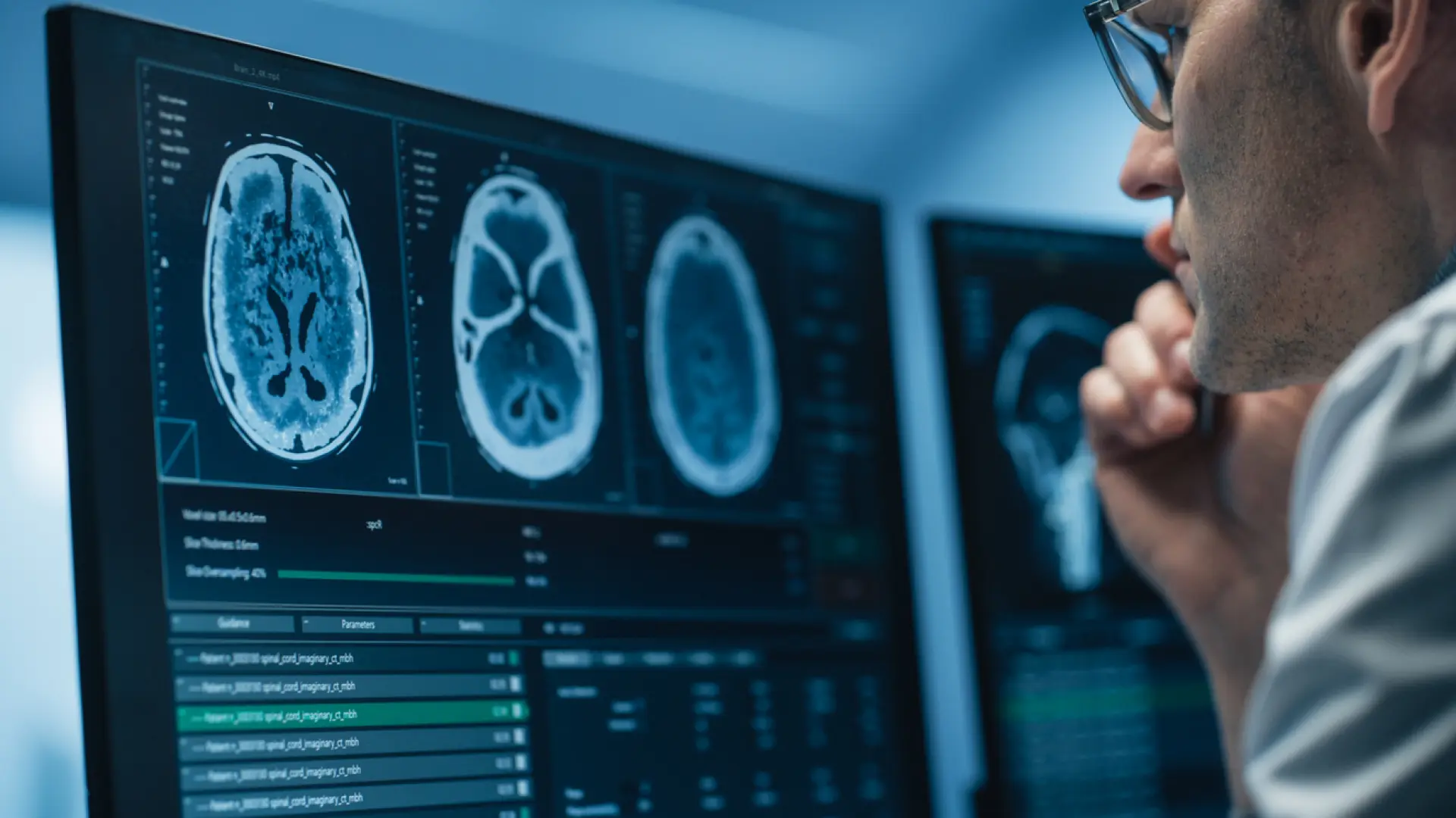 Un nuevo tratamiento logra controlar el tumor en el 96% de pacientes con un tipo de glioma cerebral