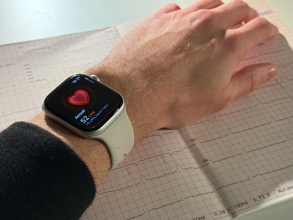 Gracias al Apple Watch y la insistencia de su hijo consiguió salvar su vida: confiar en los datos marcó la diferencia 