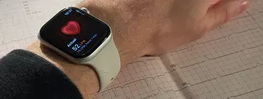 Gracias al Apple Watch y la insistencia de su hijo consiguió salvar su vida: confiar en los datos marcó la diferencia 