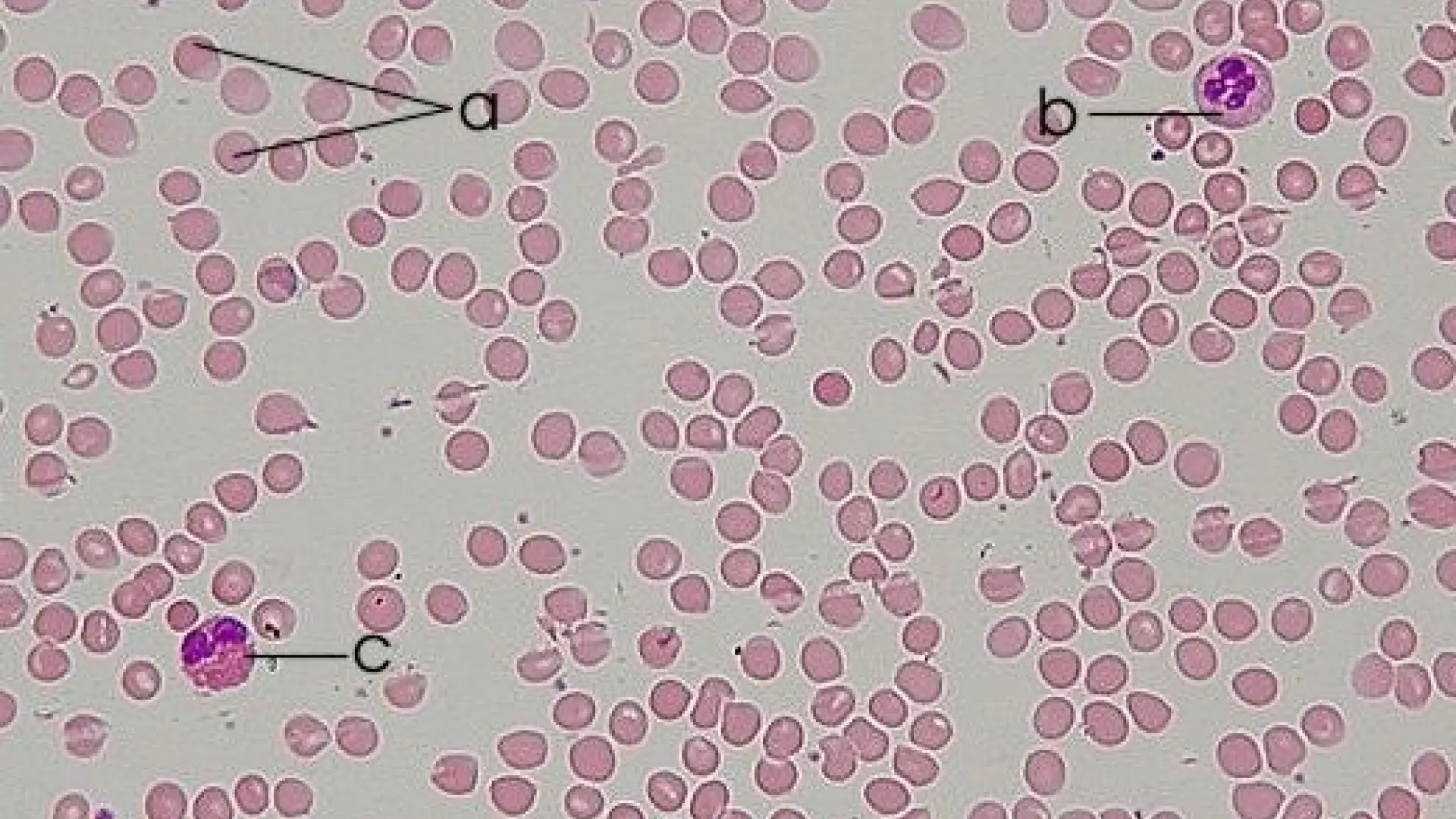 Una investigación española descubre cómo envejece la sangre y abre la puerta a métodos para revertirlo