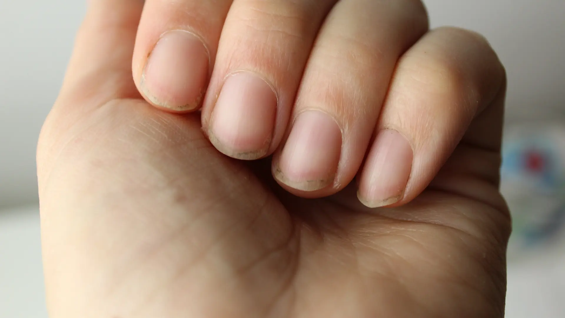 El aspecto de tus uñas te permite saber cuántos años vivirás, según un estudio de Harvard