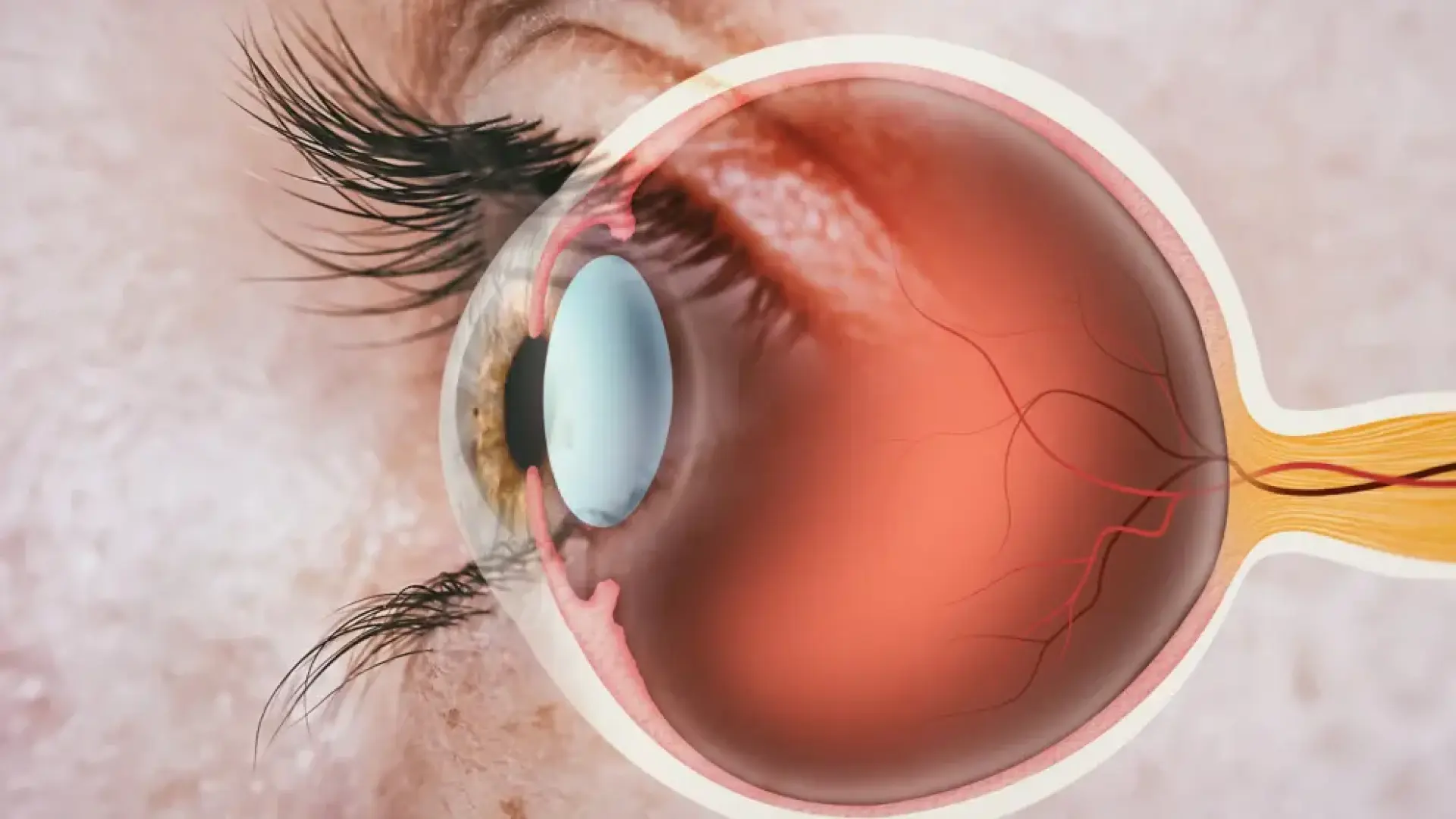 Qué son los nevus o lunares de ojos: los tres signos que debes revisar según el oftalmólogo Vicente Miralles