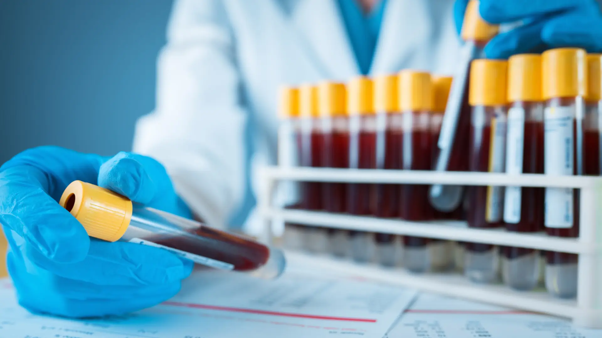 Estados Unidos aprueba el primer test de sangre para detectar el alzhéimer