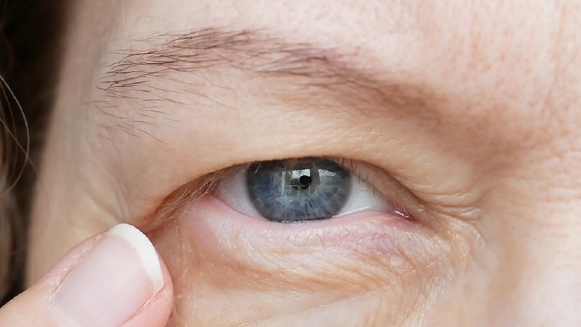 ¿Cómo poner solución a la mirada cansada?