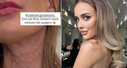 Modelo quería el cuello de Kris Jenner y se sometió a procedimiento estético que la dejó peor que antes