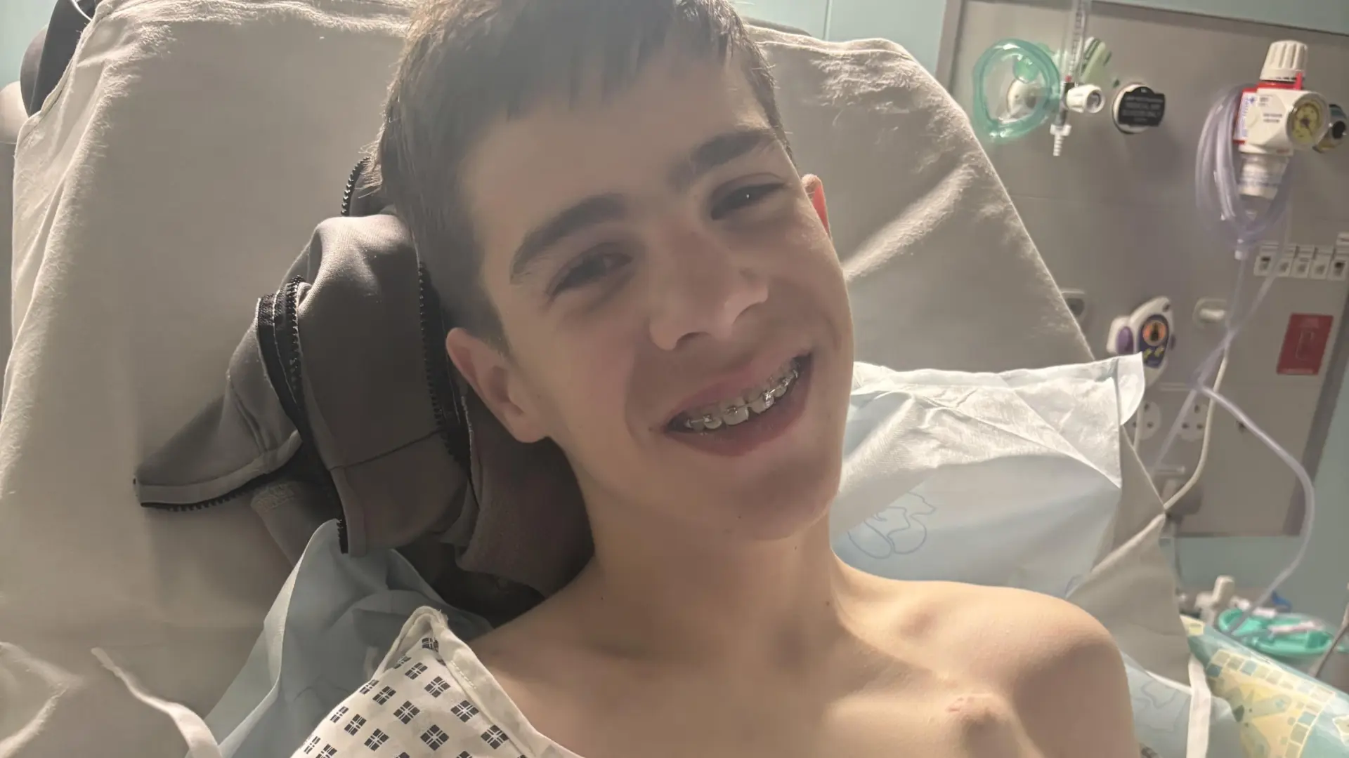 El curioso caso de Finley Ranson, un chico de 14 años que no puede comer ningún alimento y desconcierta a médicos de todo el mundo