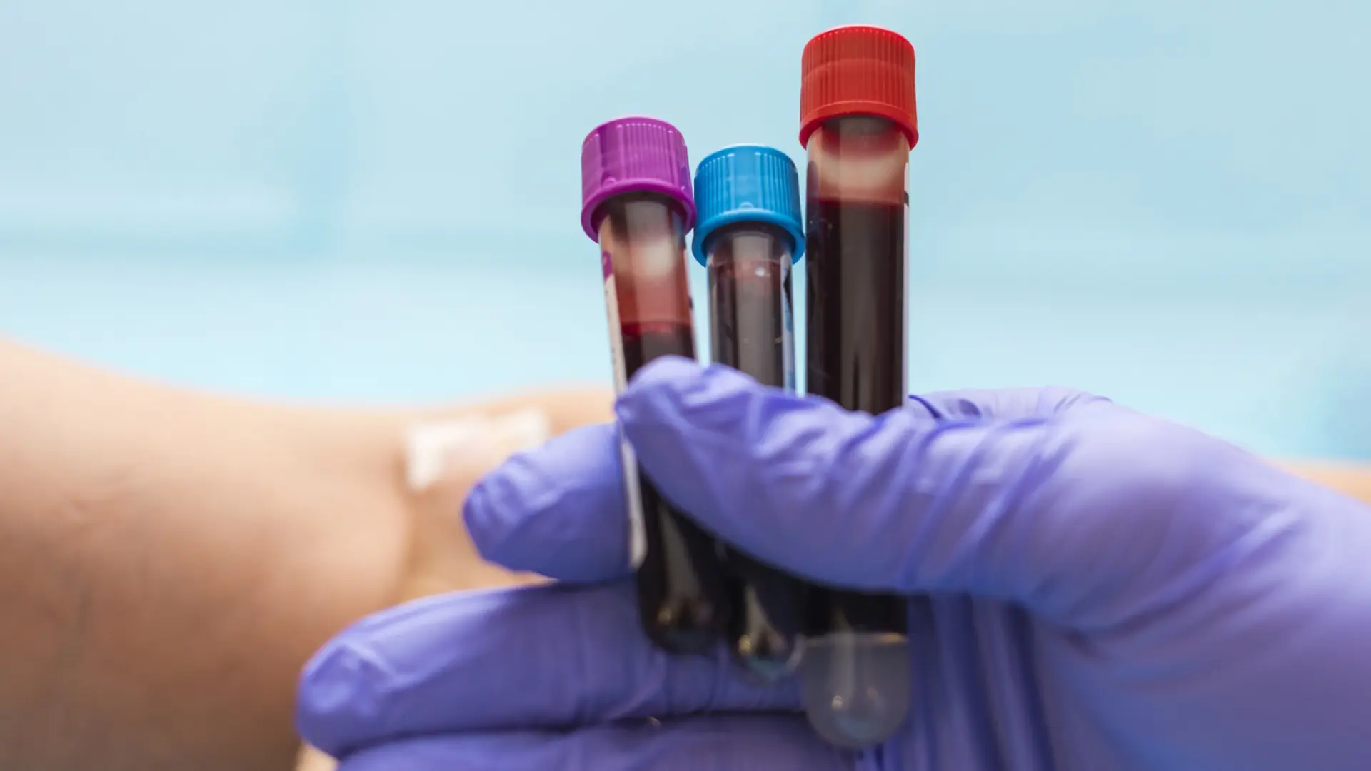 Desarrollan un test capaz de detectar tumores en estadios iniciales con muestra de sangre