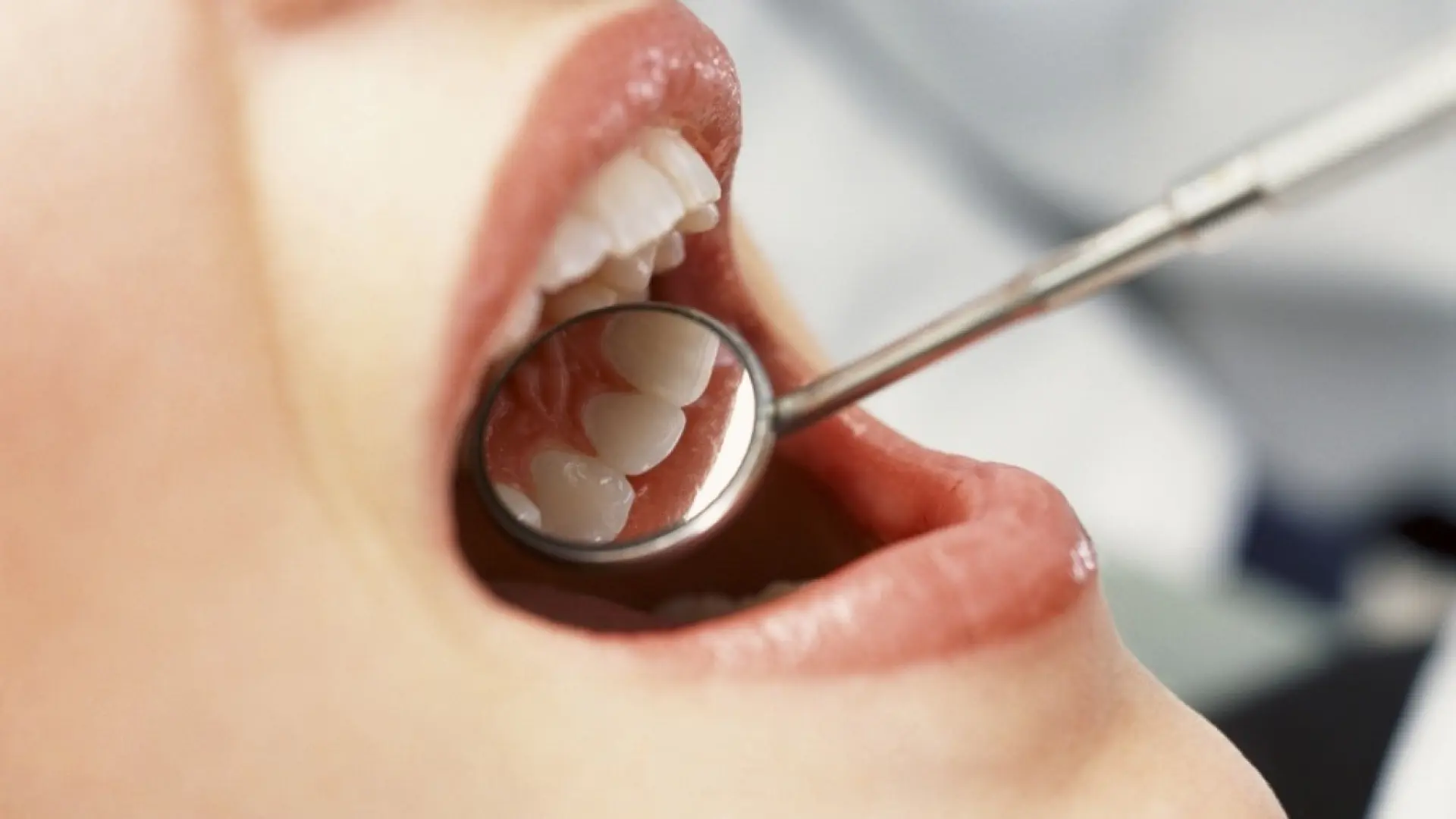 El aviso de los odontólogos sobre el 'boom' del turismo dental en Marruecos: "No es una aventura, es una temeridad"