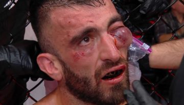 Escalofriante lesión en UFC Abu Dhabi: Mohammad Yahya quedó con un ojo a punto de explotar y pararon su pelea con Steven Nguyen