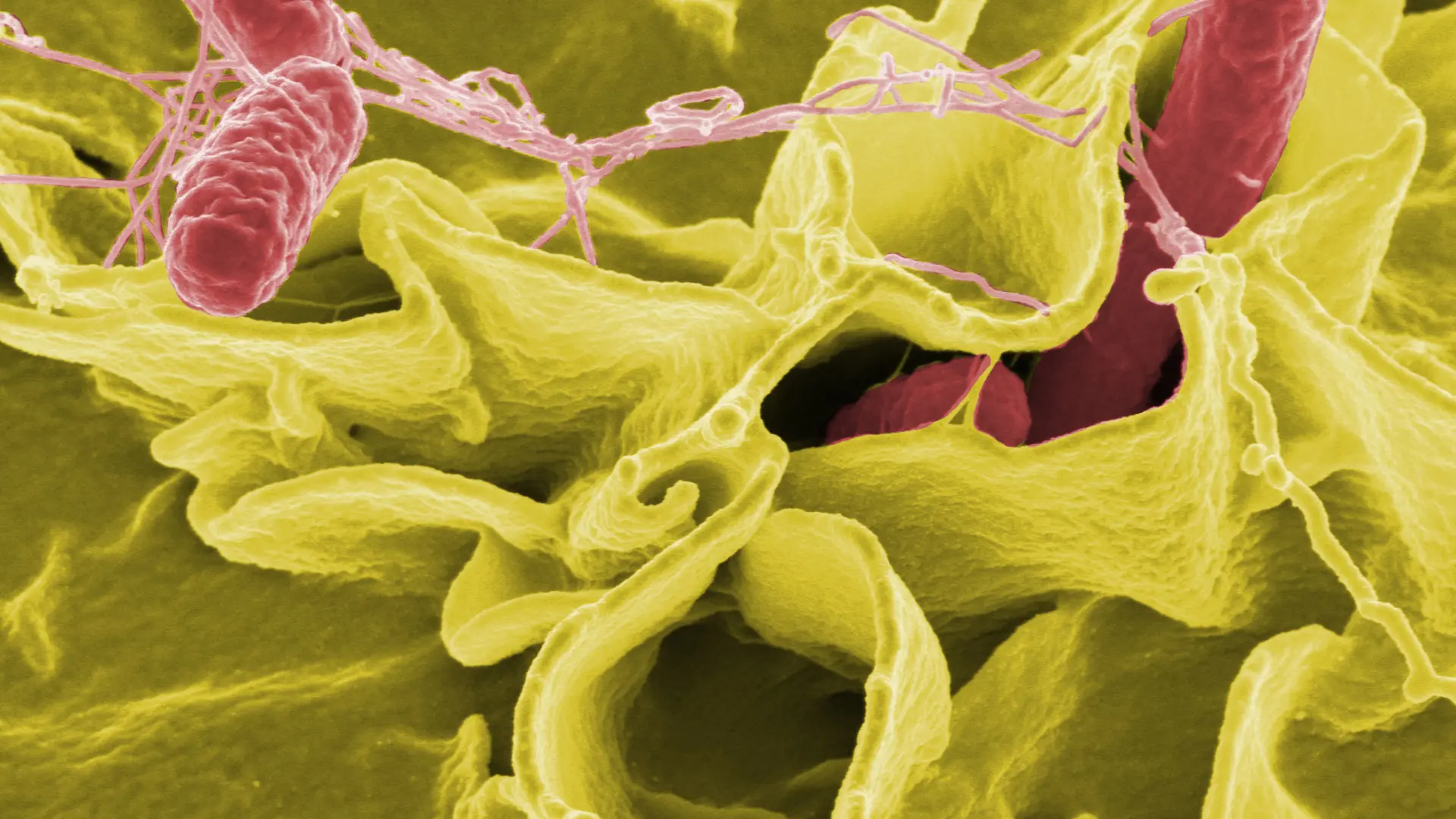 Qué es la salmonelosis, la violenta infección intestinal que han sufrido 162 personas que asistieron a un festival de A Coruña