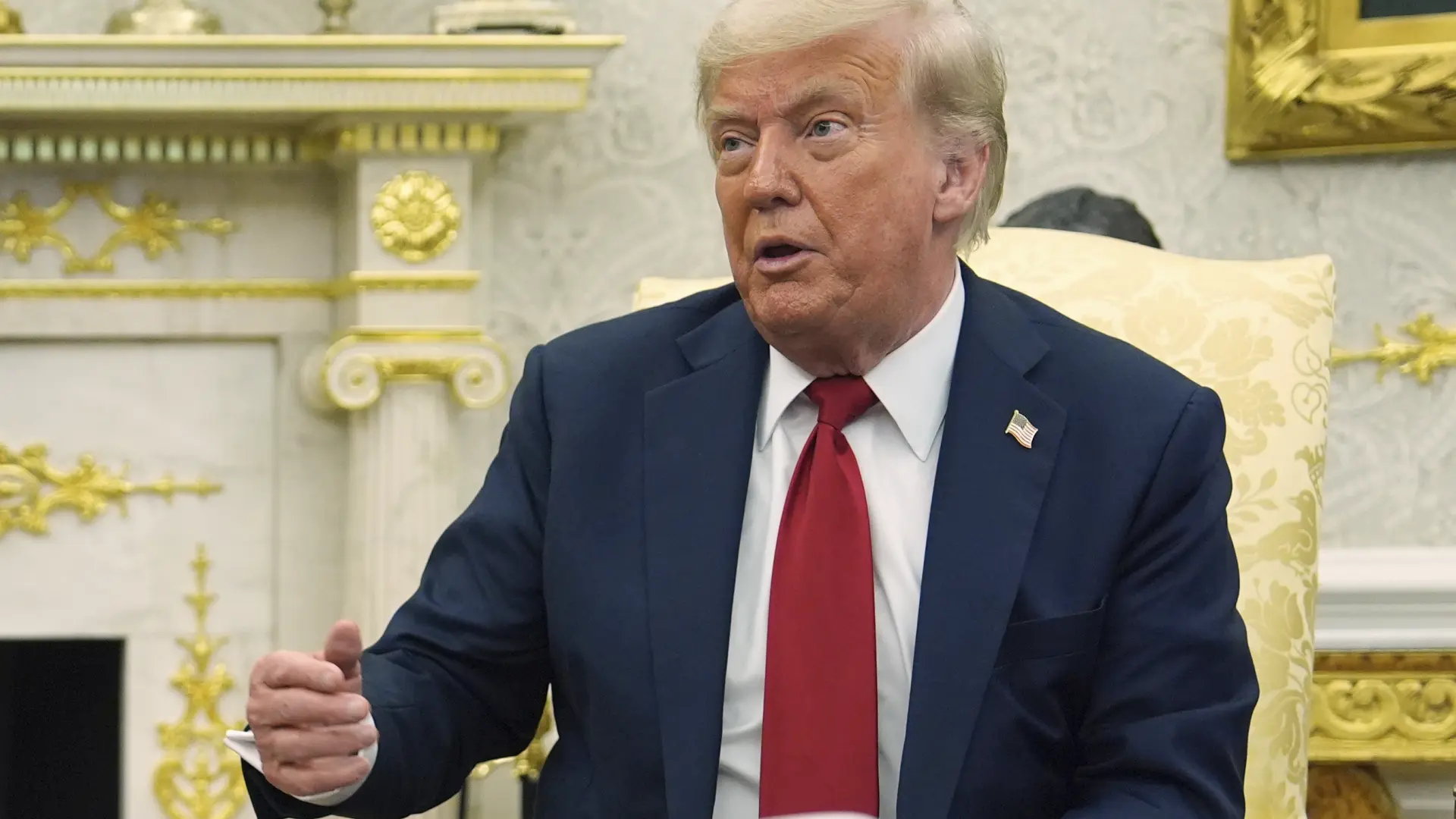 Trump sufre "insuficiencia venosa crónica": se sometió a un chequeo por inflamación en las piernas y hematomas en una mano