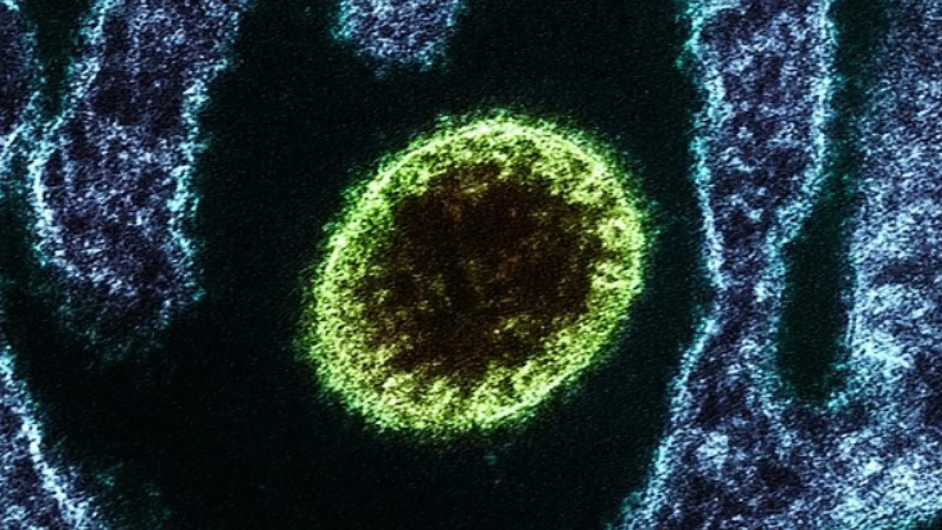 Una joven muere y otra está en la UCI por el virus Nipah, vigilado por la OMS como posible 'próxima pandemia'