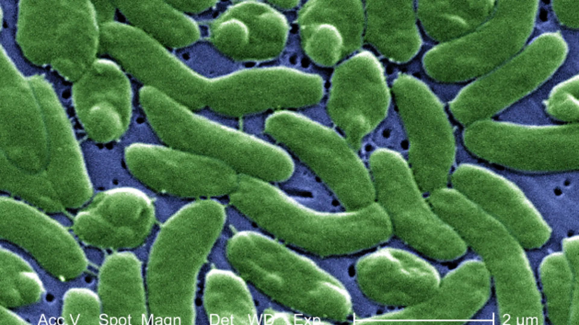 Una bacteria 'come carne' provoca la muerte de cuatro personas en Florida