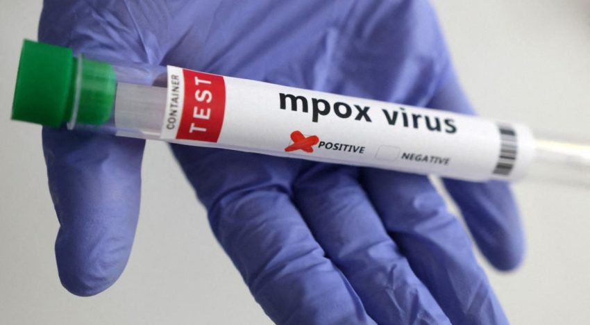 La OMS omite a México en su reporte sobre viruela del mono pese a la tendencia creciente