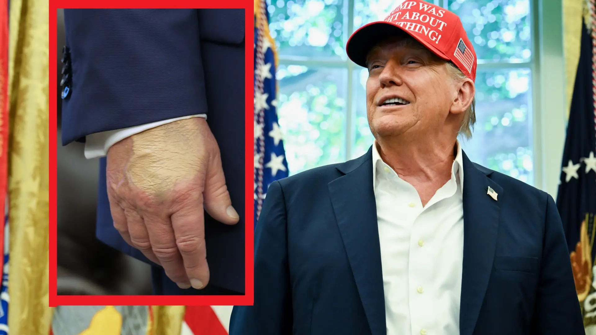 Una capa de maquillaje en una mano de Donald Trump dispara de nuevo los rumores sobre su salud