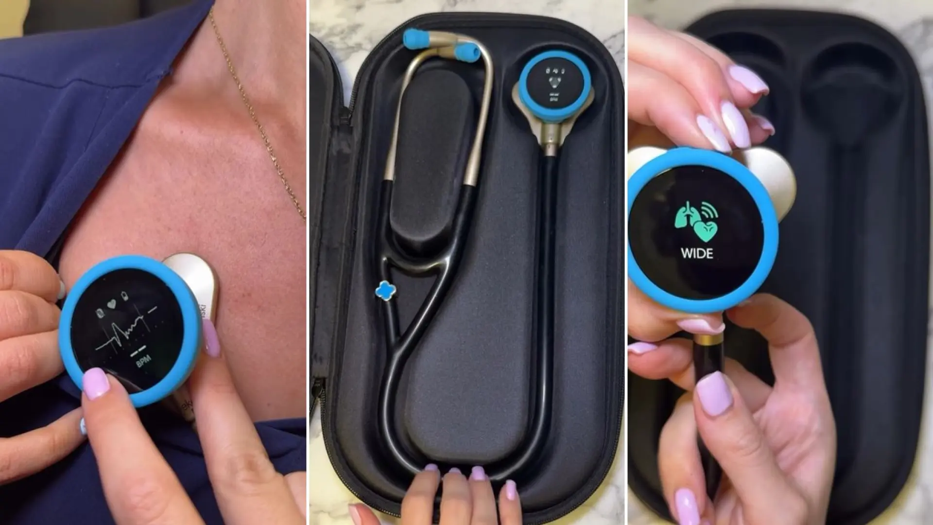 Desarrollan un estetoscopio con IA capaz de detectar enfermedades cardiacos en solo 15 segundos