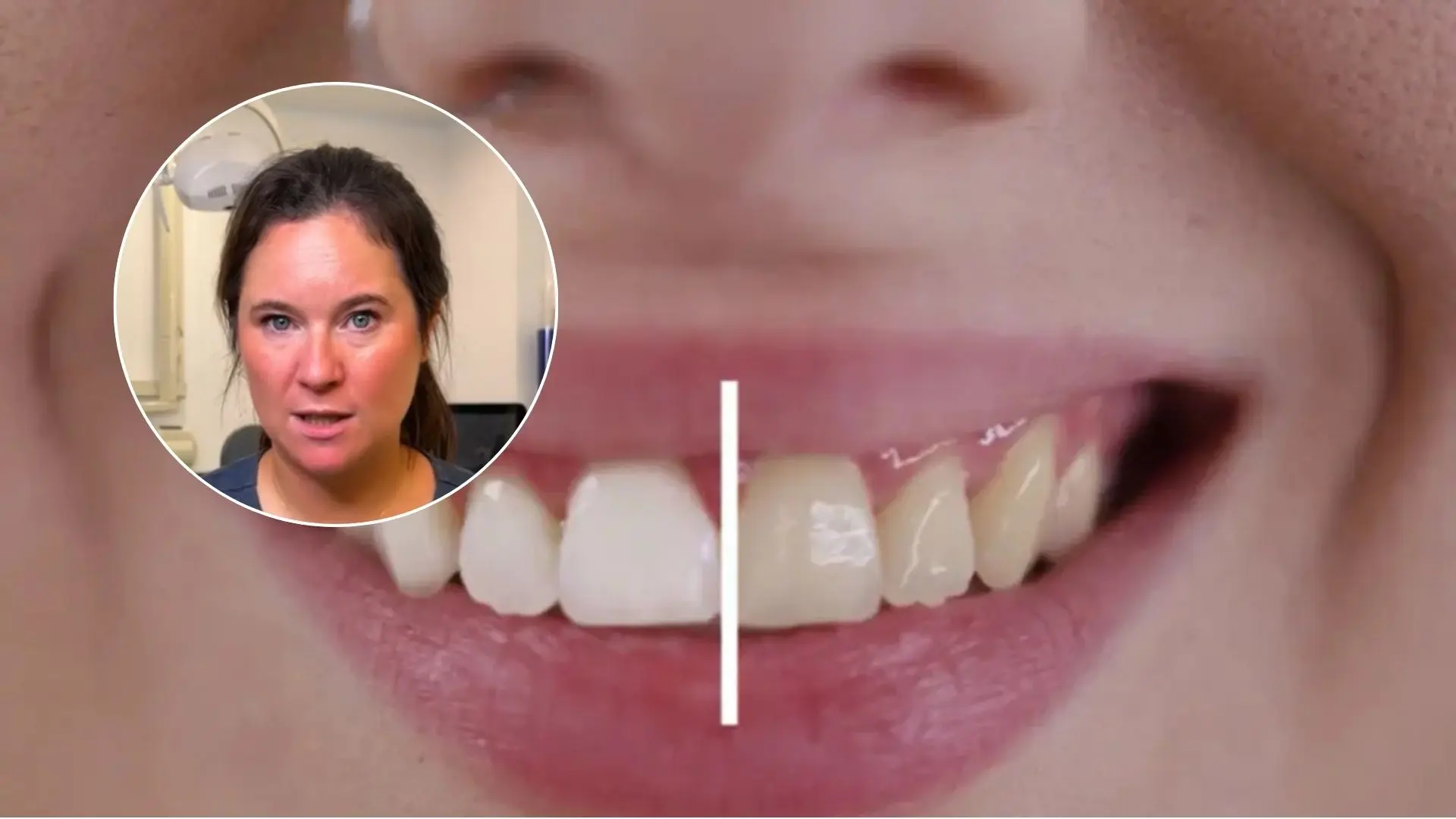 Almudena Herraiz, ortodoncista, sobre los dientes amarillos: «No solo son por falta de higiene»
