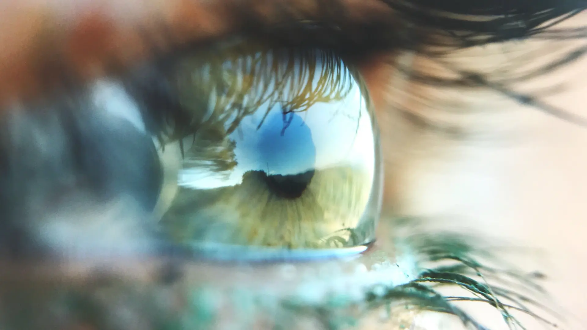 Un joven de 34 años recupera la vista… gracias a que le implantan un diente en el ojo