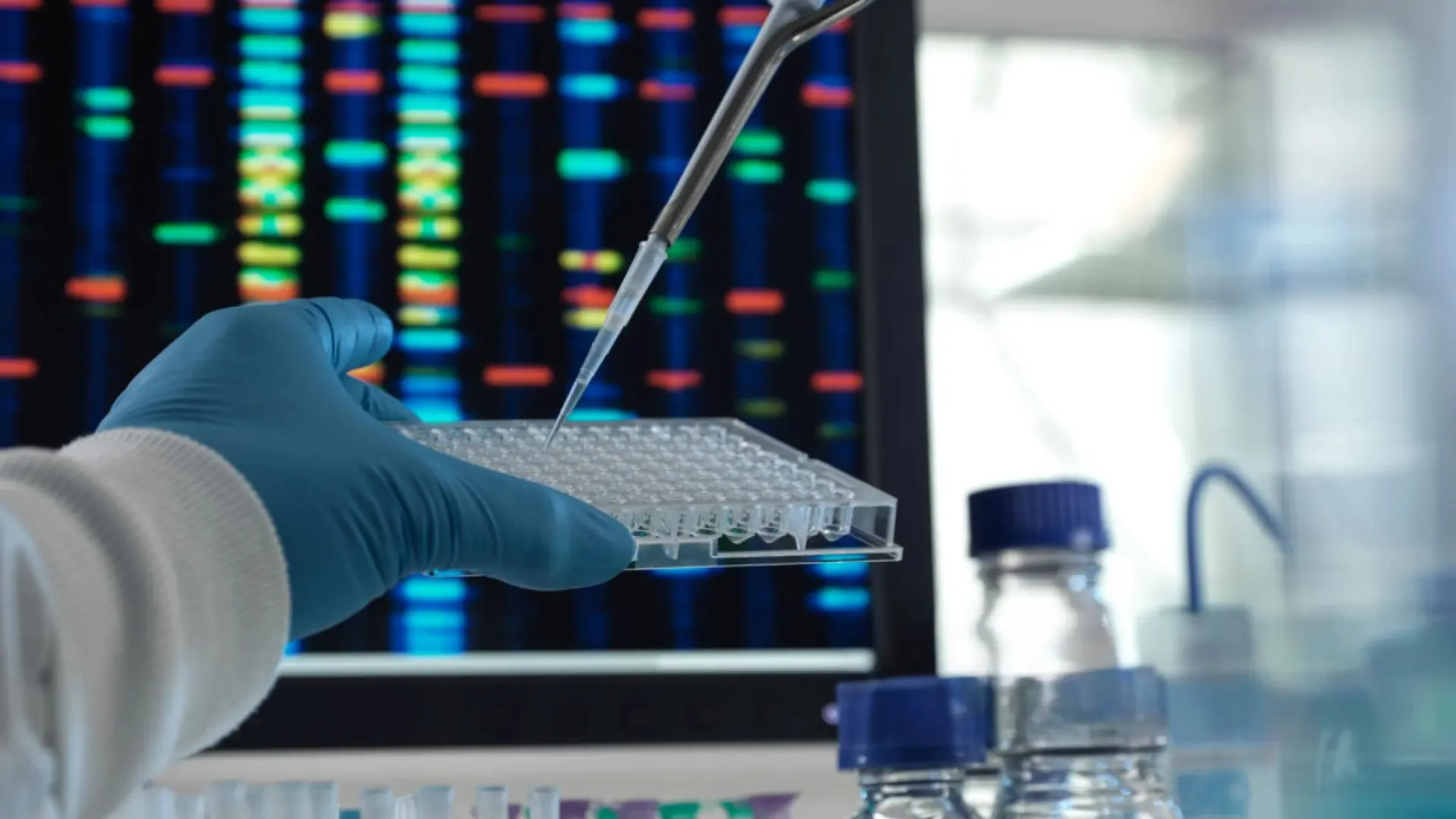 Una nueva terapia génica para el huntington logra ralentizar la progresión de la enfermedad en un 75%