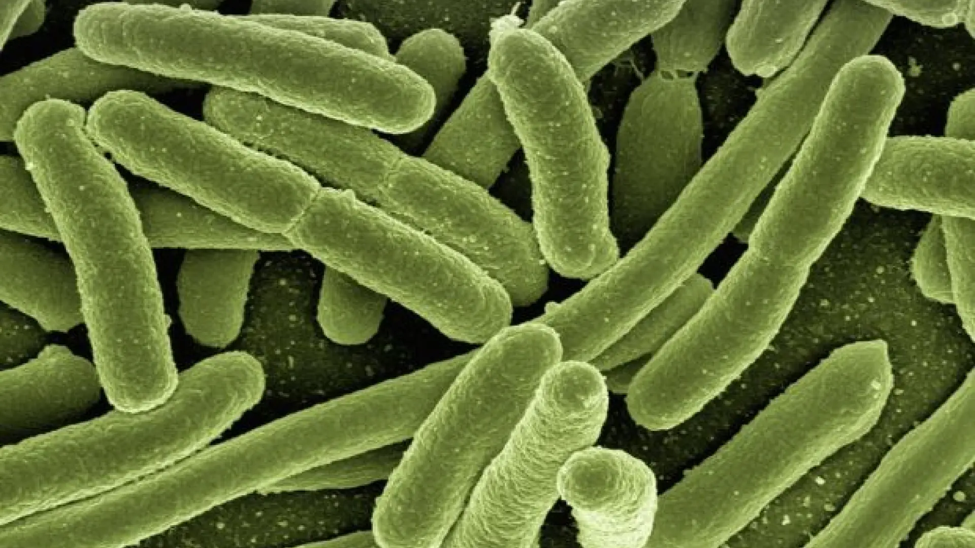 Alerta en EEUU: las infecciones por las «bacterias pesadilla» se disparan un 70% en cuatro años