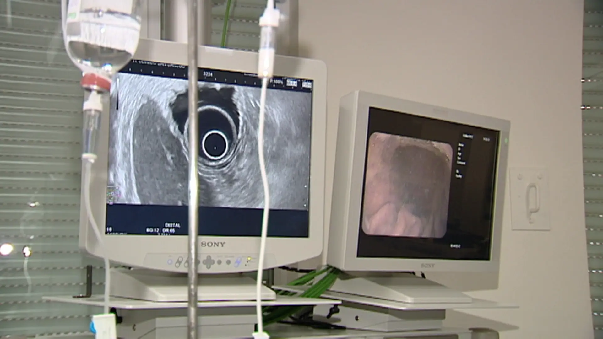 Un estudio halla una terapia con «mayor eficacia» que la estándar en cáncer de mama metastásico