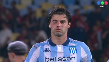 Santiago Sosa quedó con el ojo como un boxeador por un codazo de Marcos Rojo en la semifinal de la Libertadores de Flamengo vs Racing